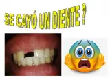 Prótesis Dental Removible Acrílica Provisoria.